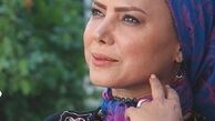 عکس خانم بازیگر بدون مو