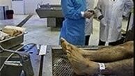 بیمارستان‌هایی که قاچاقی پیوند می‌کنند