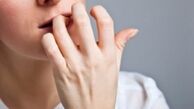 عادت هایی که چهره‌تان را زشت می‌کند