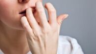 عادت هایی که چهره‌تان را زشت می‌کند