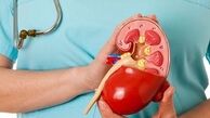  واکنش وزارت بهداشت به معترضان واگذاری دیالیز به بخش خصوصی 
