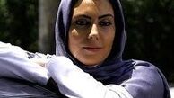 آیا نیلوفر شهیدی بینی اش را عمل کرده؟