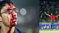  مرد محبوب پرسپولیس: صورت من هم بخیه خورد 