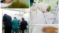 دست قطع شده کودک زلزله زده پیوند زده شد