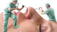 جراحی پلاستیک برای تغییر سرنوشت! +عکس