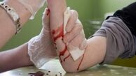 طراحی باند تزریقی به منظور جلوگیری از خون‌ریزی‌های شدید