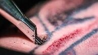 عوارض خالکوبی و تتو چیست؟ 