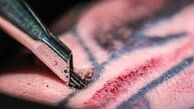 عوارض خالکوبی و تتو چیست؟ 