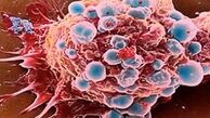 مردان بیشتر به سرطان مبتلا می شوند یا زنان؟ 