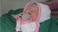 زایمان سزارین احتمال ابتلا به زردی نوزاد را افزایش می‌دهد
