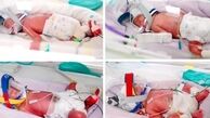 تولد چهارقلوهای همسان در استرالیا؛ یکی از نادرترین زایمان‌های جهان