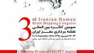 کنگره بین‌المللی نقشه‌برداری مغز برگزار می‌شود