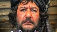 صورت زخمی امیرحسین صدیق در یک فیلم