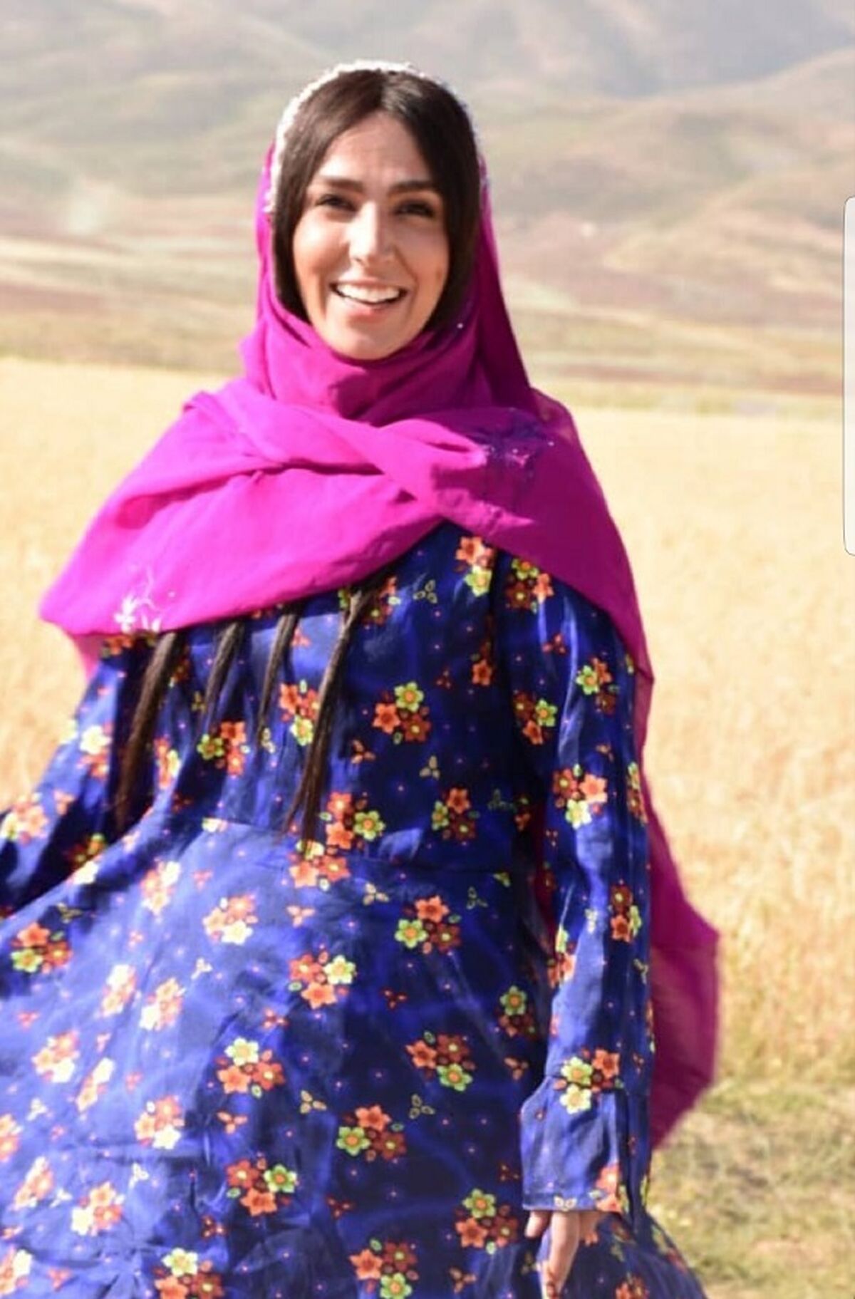 سوگل طهماسبی با مو مصنوعی+عکس