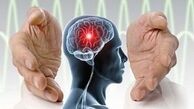 وقتی بخش بزرگی از مغز سکته می‌کند