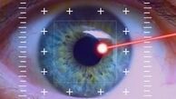 ابتلای نیمی از جامعه به نزدیک بینی طی 30 سال آینده