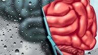 آلزایمر ۳ نوع دارد