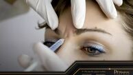 عوارض تزریق بوتاکس چیست و بعد از چند سال نمایان می شود؟