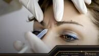 عوارض تزریق بوتاکس چیست و بعد از چند سال نمایان می شود؟
