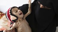 سایه شوم وبا؛ جان ۱۳ میلیون یمنی در خطر است 