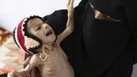 یمن و سه کشور آفریقایی در معرض تهدید گرسنگی