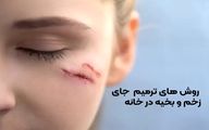 ۹ روش ترمیم جای زخم و بخیه در خانه