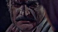 صورت خونی مهدی سلطانی + عکس
