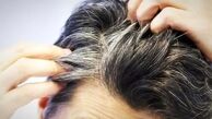 چرا باید شوره سر را جدی بگیرید؟