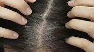 ماسک ماست و تخم مرغ روشی مناسب برای سلامت موی سر