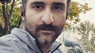 تغییر چهره بازیگر کرگدن + عکس