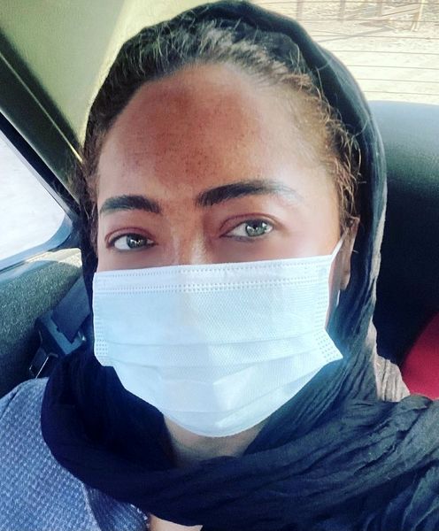 صورت آفتاب سوخته نیکی کریمی + عکس