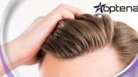 با جدیدترین روش های کاشت مو در دنیا آشنا شوید!【سال ۱۴۰۲】