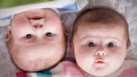 دوقلوهای پسر بیشتر عمر می کنند