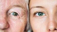 آنچه باید در مورد پیر شدن چشم‌ ها بدانیم