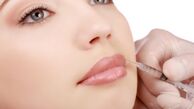 همه چیز درباره  تزریق ژل و بوتاکس