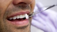 7 علت مهم زرد شدن دندان ها