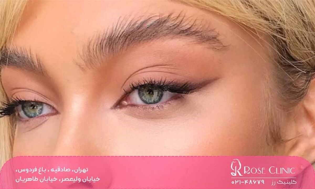علت سیخ شدن ابرو بعد از کاشت​ چیست؟