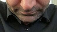 خشم مهدی کوشکی + عکس