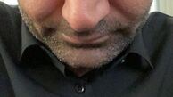 خشم مهدی کوشکی + عکس