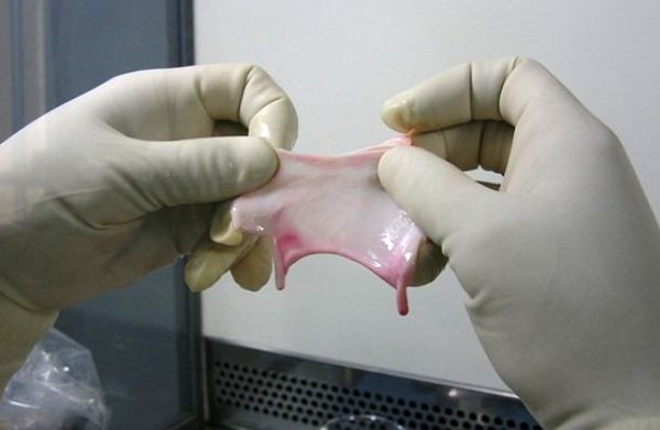 درمان آرتروز زانو با غضروف بینی !