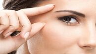 رکورد دارهای عمل های زیبایی!
