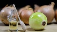 درمان باورنکردنی ریزش مو با پیاز + چند راهکار فوق العاده