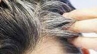 علت سفیدی مـو چیست؟