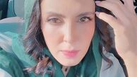 صورت آفتاب خورده لیلا بلوکات + عکس