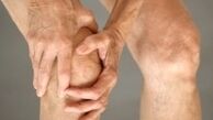 هر ۵ کیلو کاهش وزن، ۲۰ درصد پیشرفت آرتروز را کم می‌کند