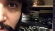 صورت نصفه و‌نیمه‌ آقای بازیگر + عکس