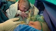 کارانه 300 میلیون تومانی، به نام ماما به کام پزشک 