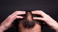 تاثیرات بی خوابی بر روی زیبایی و سلامت مو