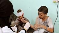 کشته و زخمی شدن چند کودک یمنی به دست ائتلاف سعودی