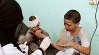 400 هزار کودک یمنی به دلیل سوء تغذیه با مرگ فاصله‌ای ندارند